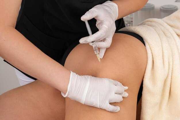 Выбор места для инъекции