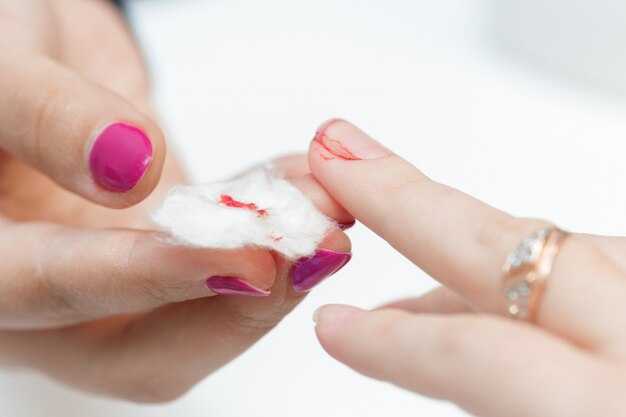 Методы снятия гель лака: обзор