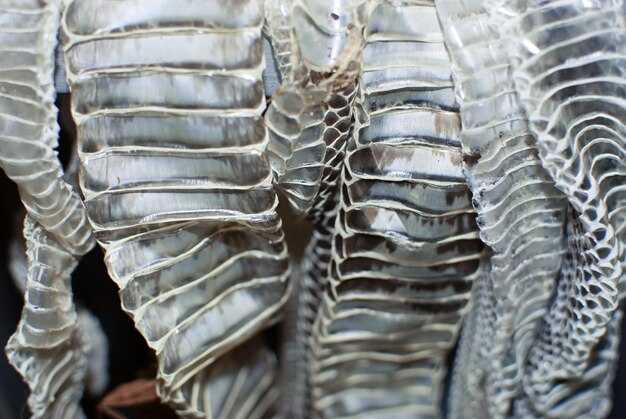 Антомическая структура соединения ребер с грудиной