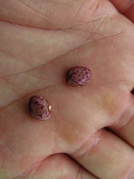 Причины появления папиллом и их вред