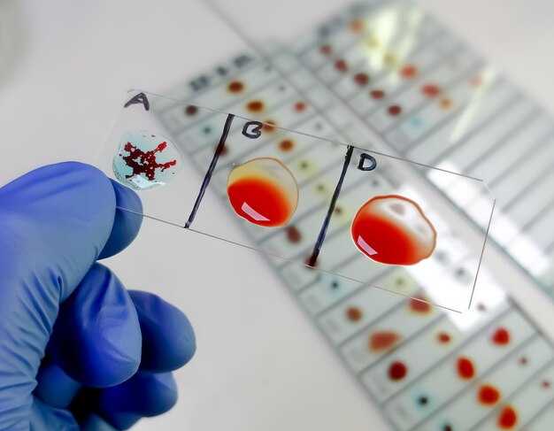 Что означает сдвиг формулы нейтрофилов