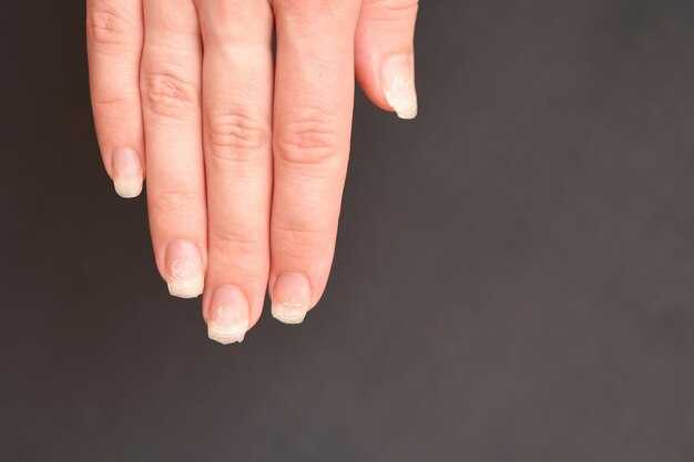 Факторы, влияющие на скорость роста ногтей