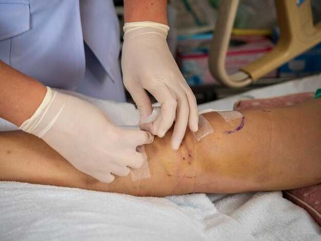 Подготовка пациента к тромболизису