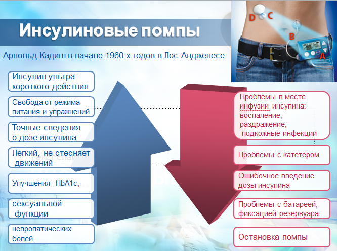 Инсулиновые помпы презентация